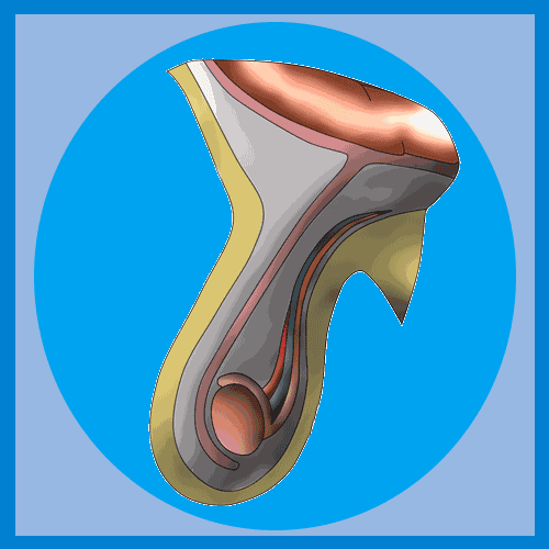 疝气补片怎么固定【腹腔镜篇】疝修补术——疝气的最佳手术方式_https://www.jmylbn.com_新闻资讯_第1张