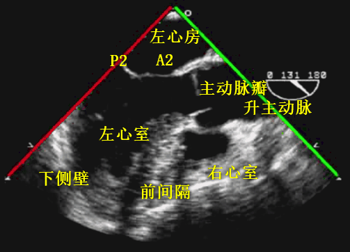 彩超探头怎么转换经食道心脏彩超（TEE）总看不懂？5 分钟掌握经典切面！（附动图）_https://www.jmylbn.com_新闻资讯_第17张