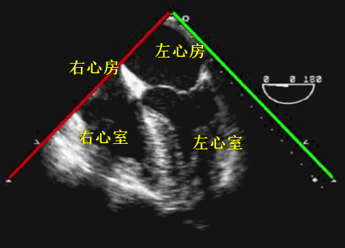 彩超探头怎么转换经食道心脏彩超（TEE）总看不懂？5 分钟掌握经典切面！（附动图）_https://www.jmylbn.com_新闻资讯_第10张