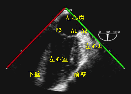 彩超探头怎么转换经食道心脏彩超（TEE）总看不懂？5 分钟掌握经典切面！（附动图）_https://www.jmylbn.com_新闻资讯_第15张