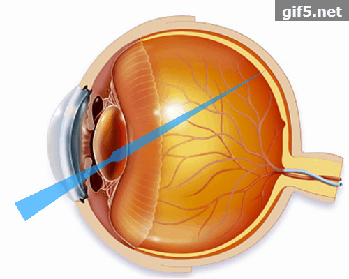 怎么看眼底相机微清Apollo相机，揭开白内障眼底的神秘面纱_https://www.jmylbn.com_新闻资讯_第11张