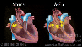 280_161gif 动态图 动图