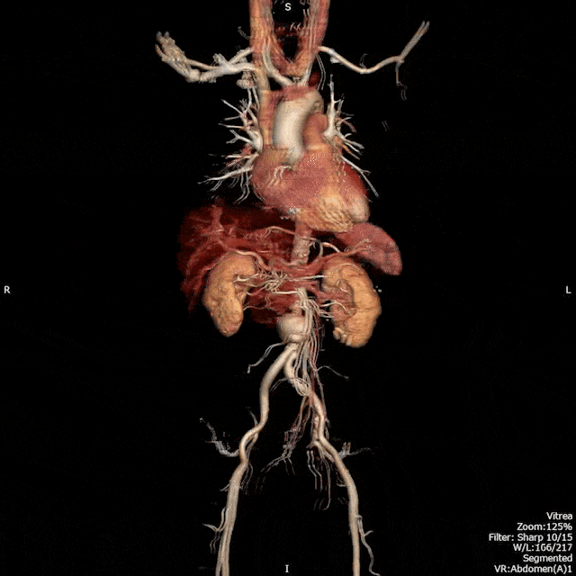 中国为什么不能生产医用螺旋ct机超高端CT中国制造！集齐影像“四大家族”！_https://www.jmylbn.com_新闻资讯_第2张