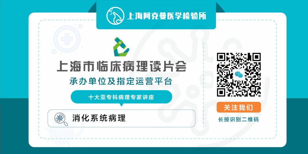 血管鞘组是什么上海市临床病理读片会精选病例（十六） —  软组织血管纤维瘤、丛状纤维组织细胞瘤、结缔组织增生性毛鞘瘤_https://www.jmylbn.com_新闻资讯_第5张