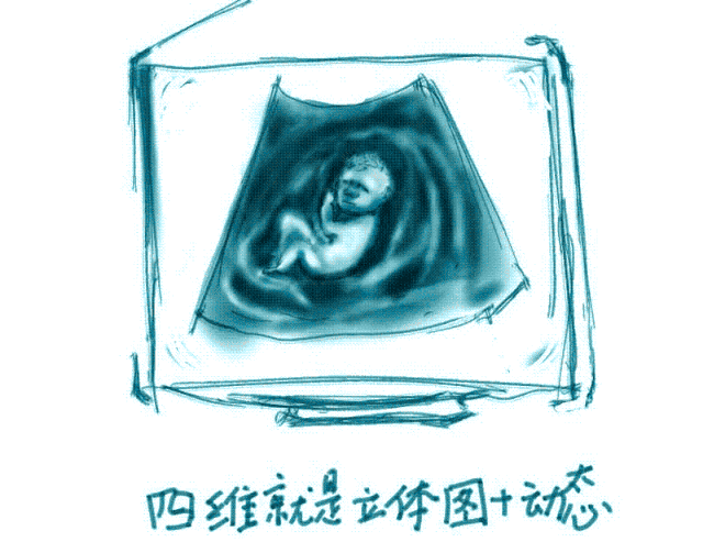 ge彩超怎么样“美国GE-E10”四维彩超界的战斗机—孕妈妈的首选！_https://www.jmylbn.com_新闻资讯_第5张