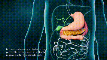 取石球囊怎么取石不开刀就能取胆管结石的方法，你了解吗？ ｜ 一页手册 · 协和八_https://www.jmylbn.com_新闻资讯_第5张