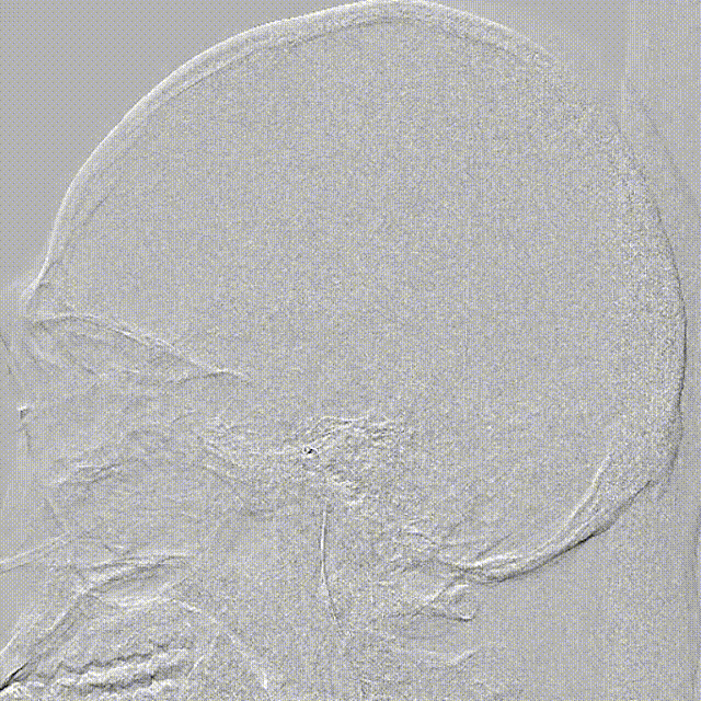 media5 00_00_00-00_00_30.gif