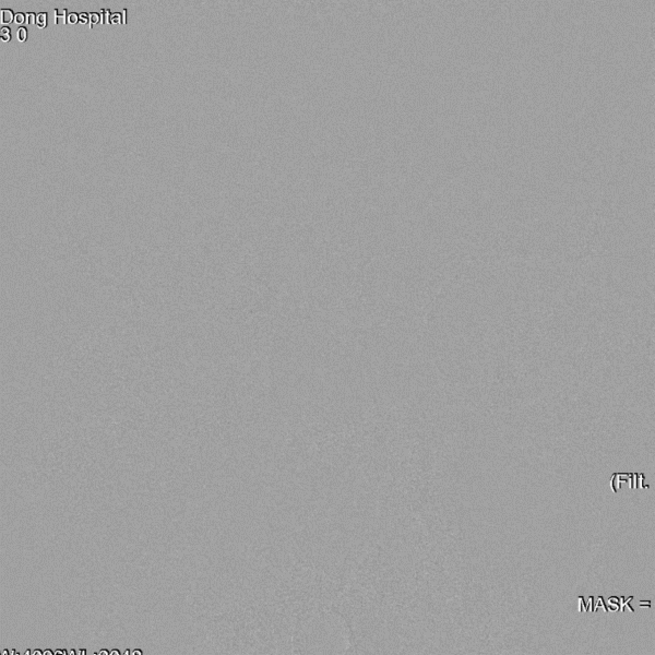 导丝怎么扩【载药时代 球扩天下】NOVA DES®颅内药物洗脱支架在症状性颅内动脉狭窄中的应用—烟台鲁东医院使用体会二例！_https://www.jmylbn.com_新闻资讯_第15张