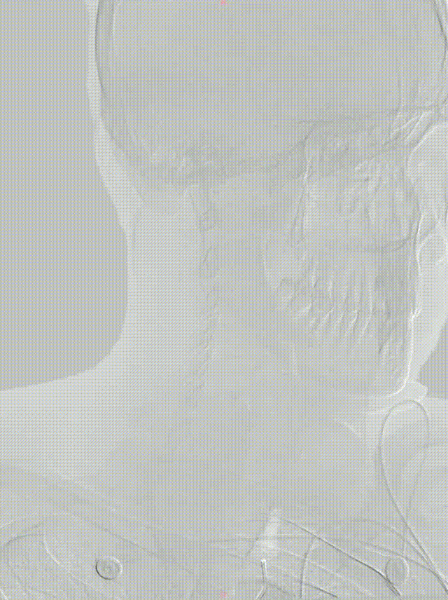 media4 00_00_00-00_00_30.gif