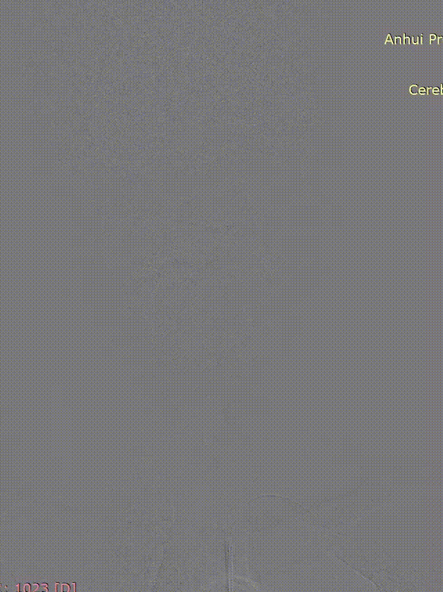 media1 00_00_00-00_00_30.gif