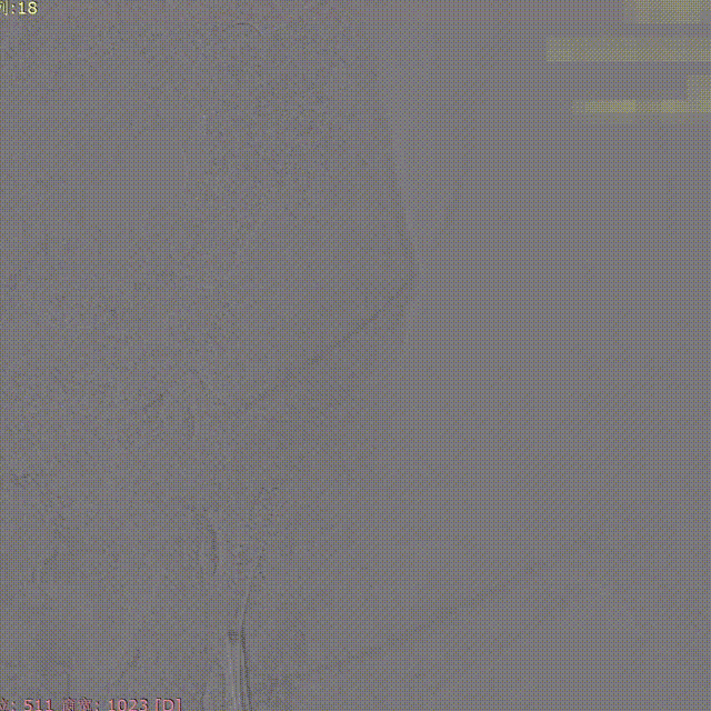 media2 00_00_00-00_00_30.gif