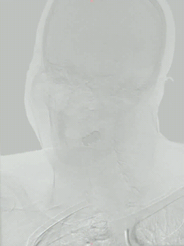 media4 00_00_00-00_00_30.gif