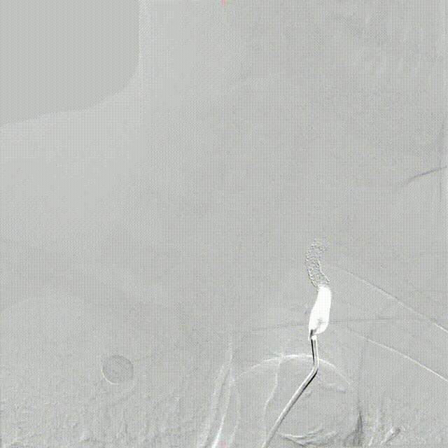 media3 00_00_00-00_00_30.gif