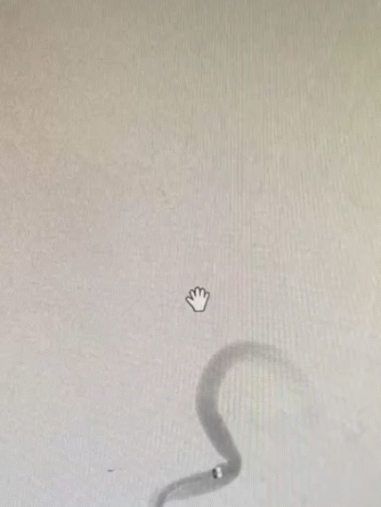 导丝怎么扩【载药时代 球扩天下】NOVA DES®颅内药物洗脱支架在颅内富穿支区域使用体会二例！_https://www.jmylbn.com_新闻资讯_第30张