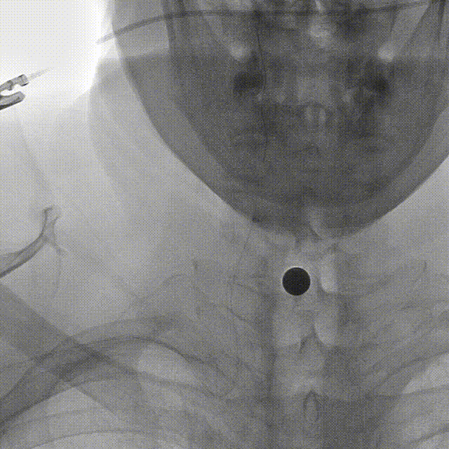media3 00_00_00-00_00_30.gif
