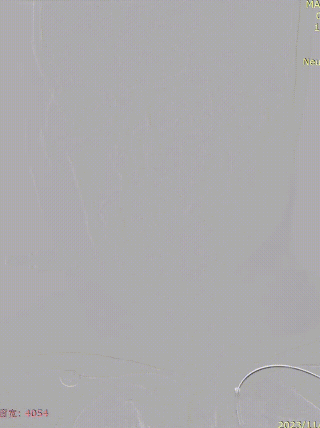 media1 00_00_00-00_00_30.gif