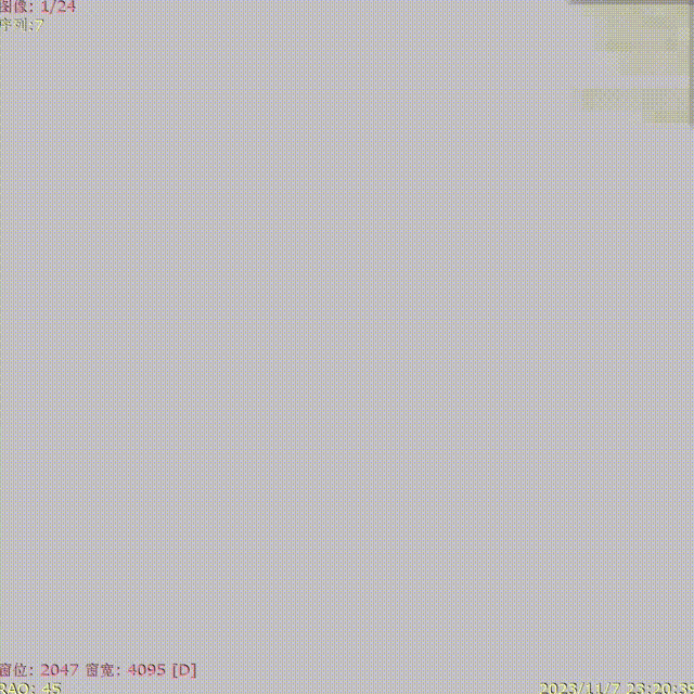 media2 00_00_00-00_00_30.gif