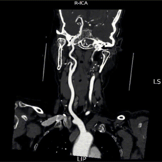 media6 00_00_00-00_00_30.gif