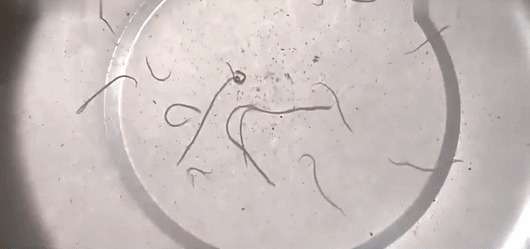 其实这并不是个例,许多家庭都在受到这种红线虫困扰,由于它本身帯有的