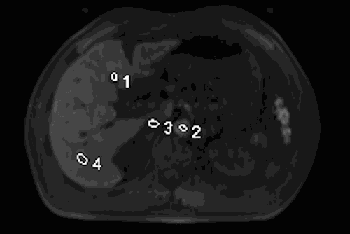 磁共振矩阵怎么计算【市一桐庐医院新设备展示】西门子 Vida 3.0T 磁共振——世界上首台具备生命矩阵系统的磁共振系统_https://www.jmylbn.com_新闻资讯_第5张
