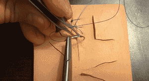 医疗缝线怎么做动图+视频，详解常见手术切口缝合技术_https://www.jmylbn.com_新闻资讯_第15张