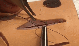 医疗缝线怎么做动图+视频，详解常见手术切口缝合技术_https://www.jmylbn.com_新闻资讯_第20张