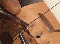 医疗缝线怎么做动图+视频，详解常见手术切口缝合技术_https://www.jmylbn.com_新闻资讯_第27张