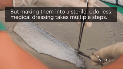 烧伤敷料怎么用图解舌尖上的医学敷料：用罗非鱼皮治疗 II 度烧伤，还能重塑阴道？_https://www.jmylbn.com_新闻资讯_第6张