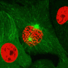 蓝光妇科治疗是什么红蓝光科普系列丨必须要知道的女性健康“拦路虎”！红蓝光来帮忙！_https://www.jmylbn.com_新闻资讯_第24张