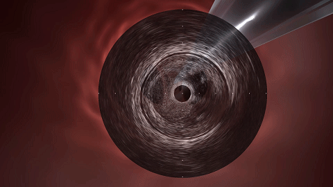 开立超声怎么导出图像开立医疗高清血管内超声诊断系统获批NMPA!_https://www.jmylbn.com_新闻资讯_第6张