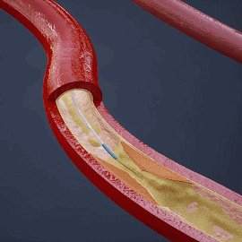 开立超声怎么导出图像开立医疗高清血管内超声诊断系统获批NMPA!_https://www.jmylbn.com_新闻资讯_第9张