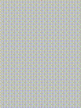 gore医疗怎么样「胸有乾坤」千钧一发 转危为安——Gore TBE治疗急诊破裂TAA一例_https://www.jmylbn.com_新闻资讯_第13张