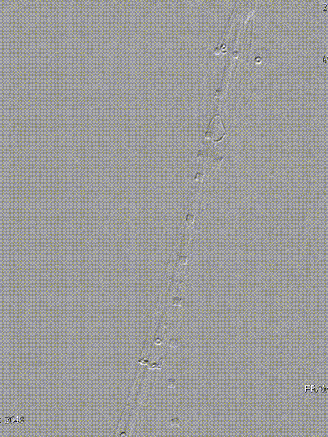 单猪尾支架怎么放【腹具匠新】吴华平教授团队：ENDURANT IIs 分叉支架开窗束径保留 IMA 治疗腹主动脉穿透性溃疡_https://www.jmylbn.com_新闻资讯_第29张