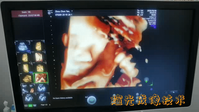 VOlusonE什么彩超机世界顶级四维彩超机美国 GE Voluson E10 BT20金标版落户吉林省吉林中西医结合医院_https://www.jmylbn.com_新闻资讯_第3张