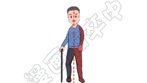 平行杠怎么拆第二册第二十九期    利用平衡杠的行走训练、手杖的选择及持杖战立_https://www.jmylbn.com_新闻资讯_第13张