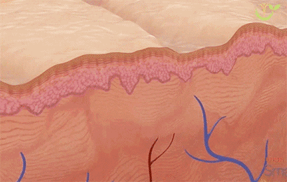 壳聚糖凝胶效果怎么样都在问的“擦伤／划伤／摔伤用什么不留疤”？答案来了_https://www.jmylbn.com_新闻资讯_第10张