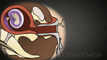 影响卵巢衰老的因素，女性都应该了解！