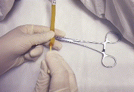 为什么要引流尿袋留置尿管护理必须掌握的操作要点——高清动图操作教学_https://www.jmylbn.com_新闻资讯_第10张