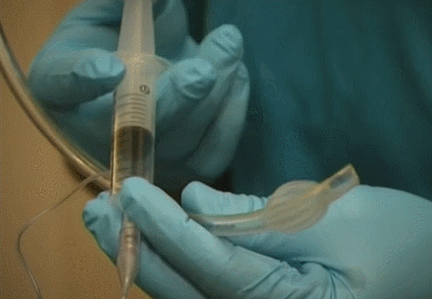 监护仪怎么使用【干货】汇集常用急救设备的使用_https://www.jmylbn.com_新闻资讯_第37张