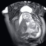 朗润核磁共振怎么样在做核磁前，不懂这些真的很危险哦！_https://www.jmylbn.com_新闻资讯_第7张