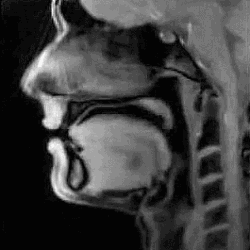 朗润核磁共振怎么样在做核磁前，不懂这些真的很危险哦！_https://www.jmylbn.com_新闻资讯_第5张
