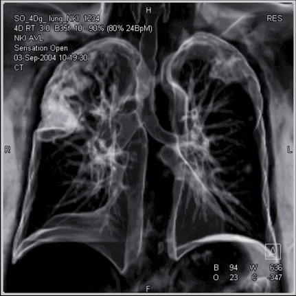 朗润核磁共振怎么样在做核磁前，不懂这些真的很危险哦！_https://www.jmylbn.com_新闻资讯_第6张