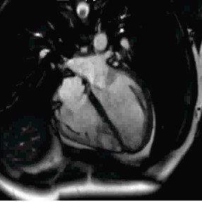 朗润核磁共振怎么样在做核磁前，不懂这些真的很危险哦！_https://www.jmylbn.com_新闻资讯_第4张