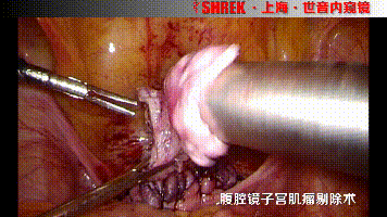 妇科器械怎么使用【妇科腹腔镜篇】常用操作器械_https://www.jmylbn.com_新闻资讯_第13张