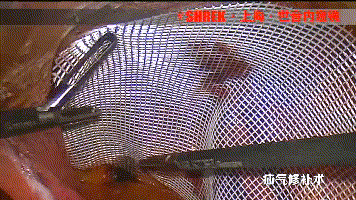 疝气补片怎么固定【腹腔镜篇】疝修补术——疝气的最佳手术方式_https://www.jmylbn.com_新闻资讯_第7张