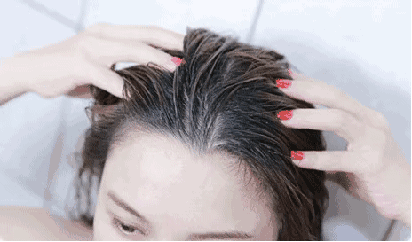 脱发掉发很严重？头皮健康问题不能忽视！