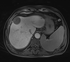 磁共振矩阵怎么计算【重磅】新一代智慧型生命感知磁共振——MAGNETOM Vida， 成功落户中大放射并全面投入使用！！！_https://www.jmylbn.com_新闻资讯_第27张