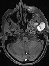 磁共振矩阵怎么计算【重磅】新一代智慧型生命感知磁共振——MAGNETOM Vida， 成功落户中大放射并全面投入使用！！！_https://www.jmylbn.com_新闻资讯_第47张