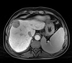 磁共振矩阵怎么计算【重磅】新一代智慧型生命感知磁共振——MAGNETOM Vida， 成功落户中大放射并全面投入使用！！！_https://www.jmylbn.com_新闻资讯_第26张