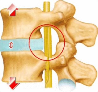 腿疼腿麻在脊柱外科的常见病因